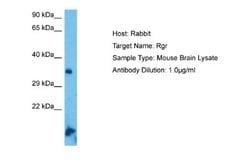 RGR Rabbit anti-Mouse, Polyclonal, Novus Biologicals 0.1ml; Unconjugated:Antikörper
